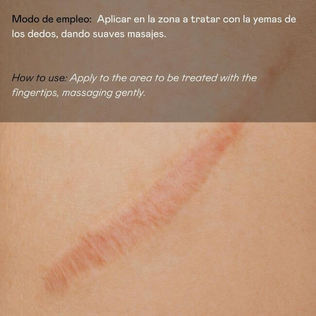 aplicar en la zona a tratar con la yema de los dedos