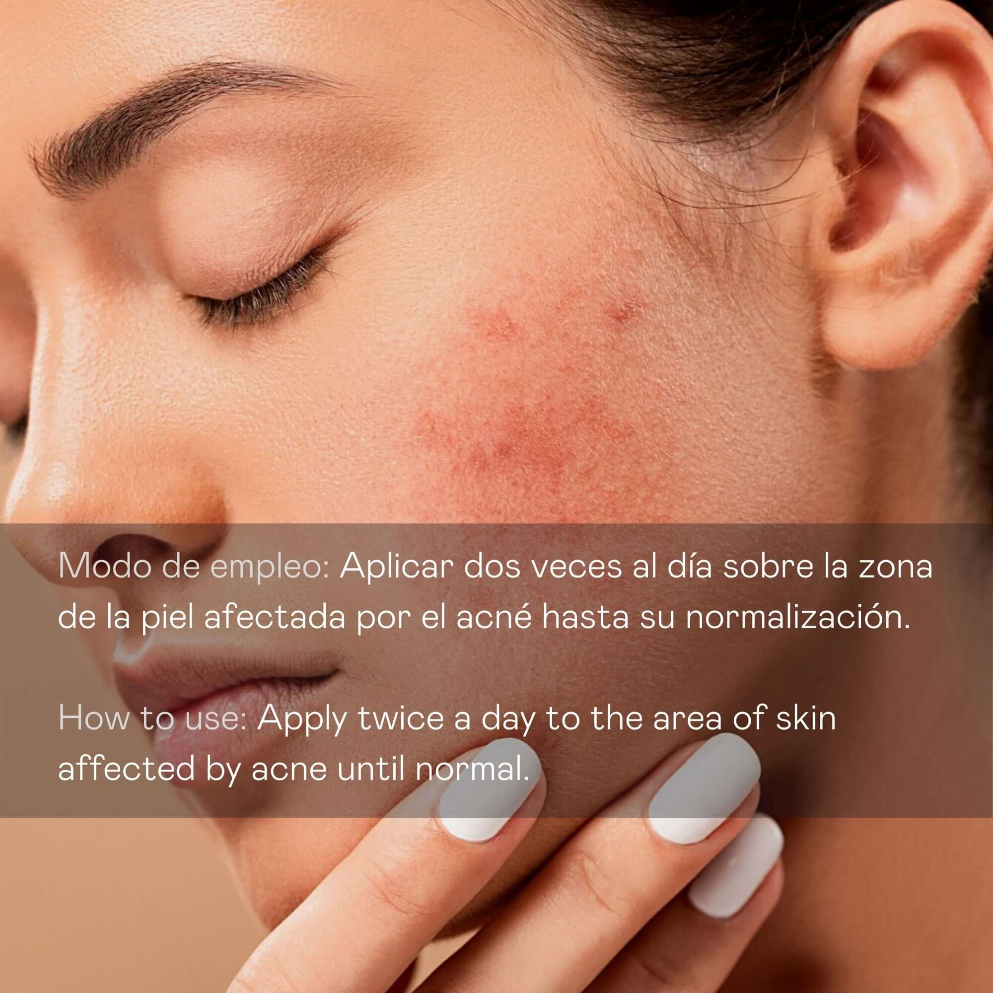 Direct anti-blemish facial serum - 30 ml