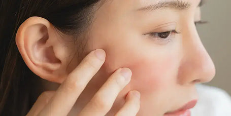 Cuidado de la piel
