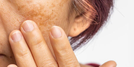 Cosméticos Faciales para Pieles con Manchas