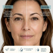 Antes y después del uso de la crema facial Retinal 0,1% de Valquer mostrando una piel más lisa, luminosa y renovada.