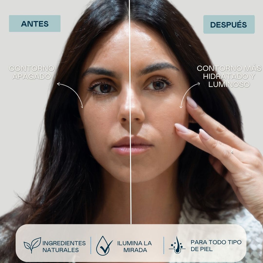 Antes y después de utilizar parches para el contorno de ojos con resultado más hidratado y luminoso