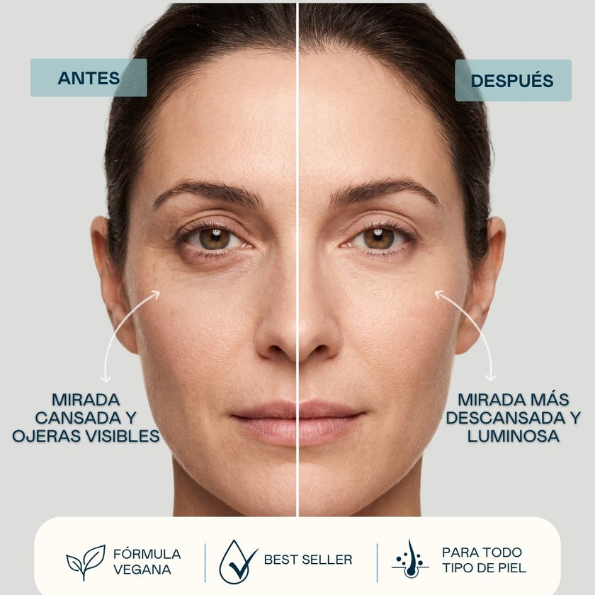 Antes y después del Sérum Contorno de Ojos y Labios Valquer, mirada más descansada