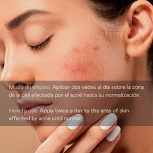 Cargar imagen en el visor de la galería, Serum facial antiacne directo - 30 ml
